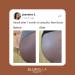 EllaBella Ms. New Booty Scrub - Walnut Exfoliator for Acne Treatment & Keratosis Pilaris Reduction | International Shipping Available - Buy Online on GoSupps.com