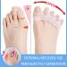 Toe Separator 6 PCS - Bunion Corrector Spacers for Men & Women | Restore Toe Shape - Blue - Buy Online on GoSupps.com