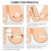Ingrown Toenail Corrector Strips - 10pcs Bottle, Straightener Clip for Thick Toenails - Foot Tool for Correction - Buy Online on GoSupps.com