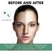 Dark Spot Cream for Face Dark Spot Cleansing Cream for Face & Body Dark Spot Cream Cleansing Spot Pigmentation Darkness -All Skin Types (50ml/1.7 fl oz) - Buy Online on GoSupps.com