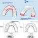 8-Piece Comfortable Mouth Protection for Teeth Grinding | Bite Rails & Night Guards - Available in 2 Sizes - Buy Online on GoSupps.com