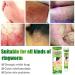 Psoriasis and Eczema Relief Cream - Soothes Dry, Itchy, and Inflamed Skin - Pack of 1 - Buy Online on GoSupps.com