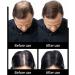 1BAG Hair Building Fibers Instant Hair Loss Treatment Color Powder Conceal Thinning Hair Add Volume For Both Men & Women(Black)  - Buy Online on GoSupps.com