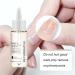 DUBUSH 7 day nail growth strengthening serum nail cuticle oil strengthener natural toenail treatment oil stronger nails in 1 week nail strengthening treatment treatment - Buy Online on GoSupps.com