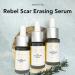 Rebel Skin Care Face Serum for Blemishes & Scars - All Natural 15ml Oil for Women & Men Acne Spot Reducer - Made in USA - Buy Online on GoSupps.com