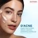 D'Ac.ne Soft Face Wash - Unclogs Pores Prevents Pimples | 1% Glycolic Acid & Niacinamide | Oily & Acne-Prone Skin | 100 ml - Unisex - Buy Online on GoSupps.com