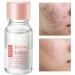 Spot Lotion 10 ml Drying Solution for Spots and Moisturizers | Fast-Acting Liquid for Facial Blemishes for Women for Daily and Nighttime Use Travel and - Buy Online on GoSupps.com
