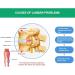 Decompression Belt for Back Pain Relief | Sciatica Traction Device | Lower Back Support - Beige - Buy Online on GoSupps.com