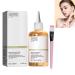 7% Glycolic Acid Toning Solution 100ml Glycolic Acid Toner Glycolic Sour 7% Toner for Blemishes Glycolic Acid 7% Toning Resurfacing Solution Glycolic Acid Toner