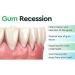 Dentizen Gum Regrowth Drops | Natural Gum Restore Liquid Mouthwash (2pcs) | International Shipping Available - Buy Online on GoSupps.com