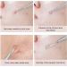 Blackhead Remover 2 PCS Pimple Popper Tool Stainless Steel Pimple Extractor Blackhead Removal Tool Risk Free Treatment for Blemish Whitehead Popping Blemish - Buy Online on GoSupps.com