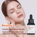 ISNTREE Hyper Niacinamide 20 Serum 20ml | Minimize Pores & Even Skin Tone | 10x Hydration with Hyaluronic Acid - International Shipping Available - Buy Online on GoSupps.com