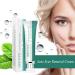 MIESCHER Acne Scar Removal Cream - Moisturizing Repair Gel for Face Pimples, Stretch Marks & Burn Scars - Acne Removal Treatment for Damaged Skin - Buy Online on GoSupps.com