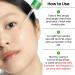 delphyr Moisturize Redness SOS Azelaic Acid 10% + Niacinamide 2% Serum Redness & PIH Soothing Vegan & Fragrance-Free Non-Comedogenic (30ml/ 1.01 fl oz.) - Buy Online on GoSupps.com