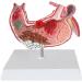 Human Stomach Lesion Model with Diaphragm Model Digestive System Model gastric Ulcer Model - Buy Online on GoSupps.com
