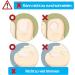 Ingrown Toenail Correction Patch - Glue-free Toe Nail File Paronychia Corrector - 4 Sizes - Foot Care Treatment Pedicure Tool - Buy Online on GoSupps.com