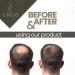 Premium Hair Fiber Spray Pump Applicator for Effortless Hair Thickening - International Shipping Available - Buy Online on GoSupps.com