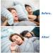 Adjustable Anti Snoring Chin Strap - Stop Snoring Solution for Men and Women - Sleep Aid for Mouth Breathers - Buy Online on GoSupps.com