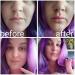 Buy Lip Sucker Plumper - Fish-Shaped Silicone Lip Pump for Full Lips | Enhance Your Beauty - Buy Online on GoSupps.com