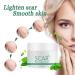 Hotiary Plant Scar Repair Cream - Acne & Stretch Mark Remover for Scars, Burns, Postoperative Skin - Men & Women - Buy Online on GoSupps.com