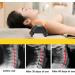 XGLL Cervical Pillow Cervical Traction Device Patient Correction Adult Spine Neck Pillow Uptodate - Buy Online on GoSupps.com