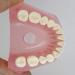 Samnuerly 28 Removable Teeth Dental Implant Model - Translucent Standard for Research & Teaching - Ideal for Removable Lower Jaw - Buy Online on GoSupps.com