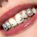 Chamon Tooth Gems | DIY Crystal Tooth Decorations | Pink Dental Jewelry & Gemstones - Buy Online on GoSupps.com