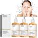 Glycolic Acid 7% Toning Resurfacing Solution -Glycolic Acid 7% Toning Resurfacing Solution for Blemishes and Acne Anti-Aging Freckle Removal Acne Tighten Pores 3bottles