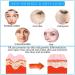 Salicylic Acid Concentrate Super Strong 2% - Acne Spot Treatment - Professional Skincare Serum White 1 - Buy Online on GoSupps.com
