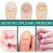 Toenail Fungus Treatment - Nail Fungus Treatment for Toenail - Anti Fungal Nail Treatment for Thickening Yellow - Brown Discoloration - Fast Extra Strong Nail Repair Solution - Buy Online on GoSupps.com