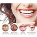 SP-6 Ultra Whitening Toothpaste - 2PCS | Deep Cleaning Care Tartar Prevention & Teeth Protection - Buy Online on GoSupps.com