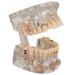 DYTAH Transparent Teeth Model Pathological Tooth with Removable Teeth for Dental Examination and Training
