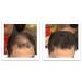 Caboki Hair Building Fiber 16G Dark Brown - Instantly Thicker Hair Solution - Buy Online on GoSupps.com