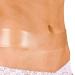 NewGel+ Advanced Silicone Scar Treatment Tape for Abdomen & Extremity - REUSABLE - Clear - Buy Online on GoSupps.com