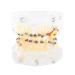 Metal Brackets Model Dental Teeth Model Orthodontic Model PVC Resin for Dental Schools