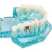 Buy Lmeil Transparent Dental Teeth Model - Ideal for Implantation & Dentist Research | Pathological Dental Model - Buy Online on GoSupps.com