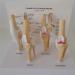 Dog Knee Joint Model Four Stage Knee Arthritis Health Knee and Dog Lesion Joint Model for Veterinary Office Teaching Aids - Buy Online on GoSupps.com