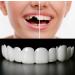 2 Pairs Regain Beautiful Smile for Men and Women Temporarily Adjustable(White)