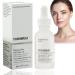 10% Niacinamide Serum+ 1% Zinc Serum Face Moisturizer High-Strength Vitamin Niacinamide Serum Face Serum for Women Minimises Pore Niacinamide Brightening Toner Hydrating Serum for Tackles Blemishes