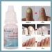 Bright Nail Repair | Best Toenail Fungus Treatment | 10 mL - Fast & Effective Infection Relief - Buy Online on GoSupps.com