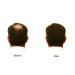 Hair Enhancer Spray for Fine/Thinning Hair - 5 oz - Beige Blonde - Buy Online on GoSupps.com
