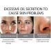 20% Azelaic Acid Serum Cream Azelaic Acid Cream Face Serum Skin Care Beauty with Niacinamide & Vitamin C Reduces Blackheads Acne Rosacea - Buy Online on GoSupps.com