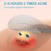 Jonov Acne Pimple Patch - Fast Acting Hydrocolloid Pimple Patches for Night - 18 Blemish Cover Stickers for Face - Buy Online on GoSupps.com