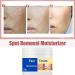 Melasma Treatment for Face Removes Facial Melasma Dark Spots Spot Cream Hyperpigmentation Treatment Sun Spots and Melasma Freckle Remover Remove Dark Spots Pigmentation Removal Cream for Face - Buy Online on GoSupps.com