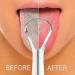 Lutiore Stainless Steel Tongue Scraper - Reusable Metal Cleaner Brush for Fresh Breath | Eco-Friendly Oral Care - Buy Online on GoSupps.com