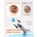 Ear Wax Removal Tool with Camera - Bebird Note 5 Ear Cleaner | Visual Earwax Cleaning Kit with Otoscope, Light, Pick & Tweezers - 3 in 1 WiFi Ear Scope for Ear Picking (Light Blue) - Buy Online on GoSupps.com