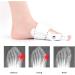 Bale Toe Corrector & Protector - Orthopedic Relief for Hallux Valgus & Hammer Toe - Buy Online on GoSupps.com