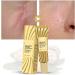 Yuemei Scar Vanishing Cream - Strengthen Skin Repair, Remove Old Scars & Stretch Marks | Suitable for All Skin Types - Buy Online on GoSupps.com
