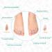 Toe Spreader for Hallux Valgus - Silicone Comfort Corrector | Pain Relief & Separator for Men & Women - Buy Online on GoSupps.com