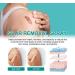 VOIV Scar Remover Spray 20g 5pcs - Relieves Itching, Removes Dark Acne - Dermatologist Recommended for All Types of Scars - Buy Online on GoSupps.com